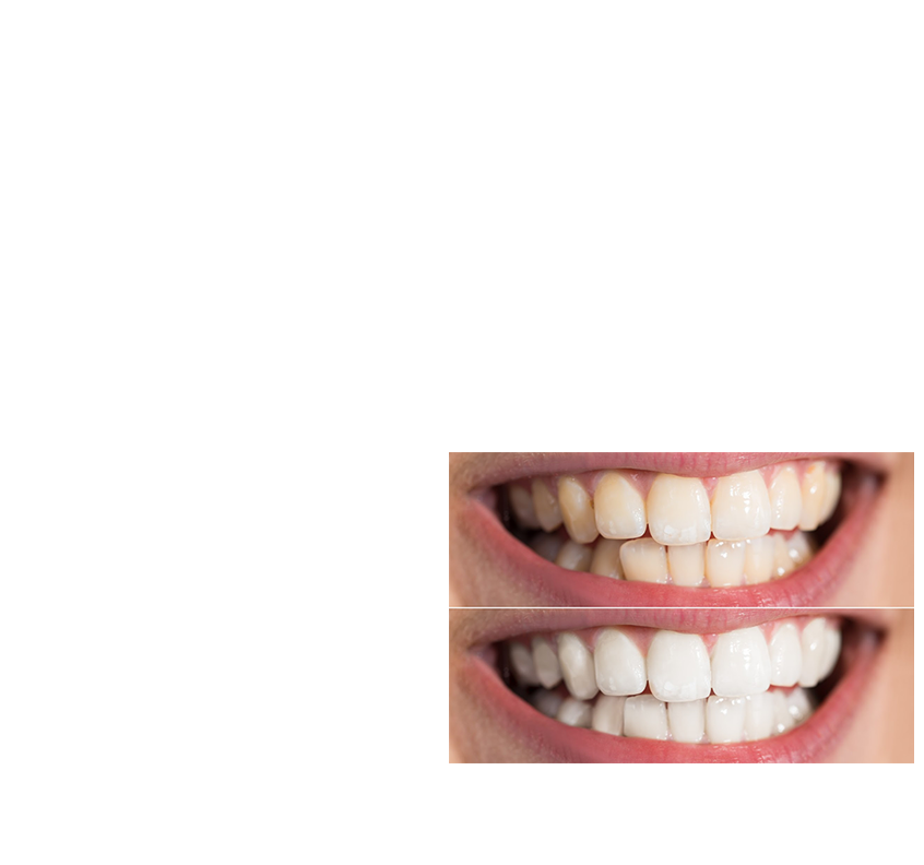 Layer